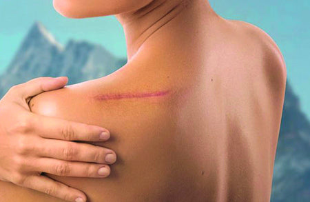 Stimola la riparazione cellulare e i processi di guarigione